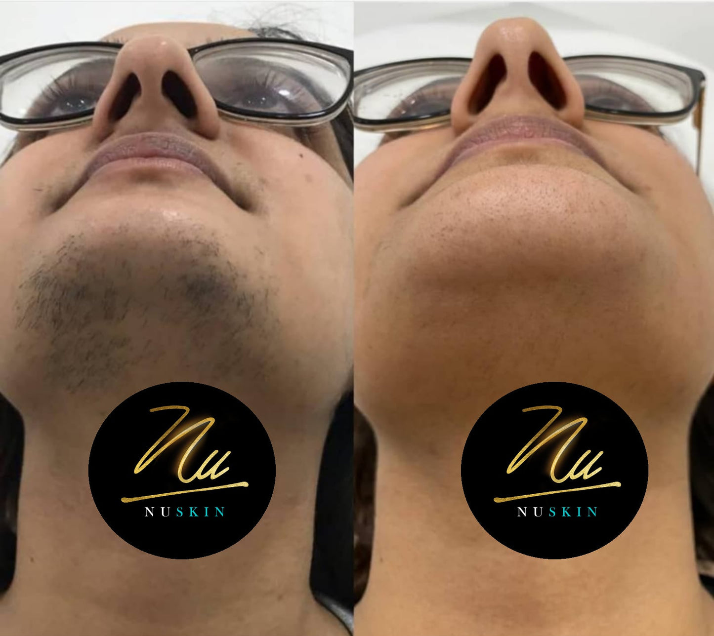 Nu Skin Unwanted Hair Stopper